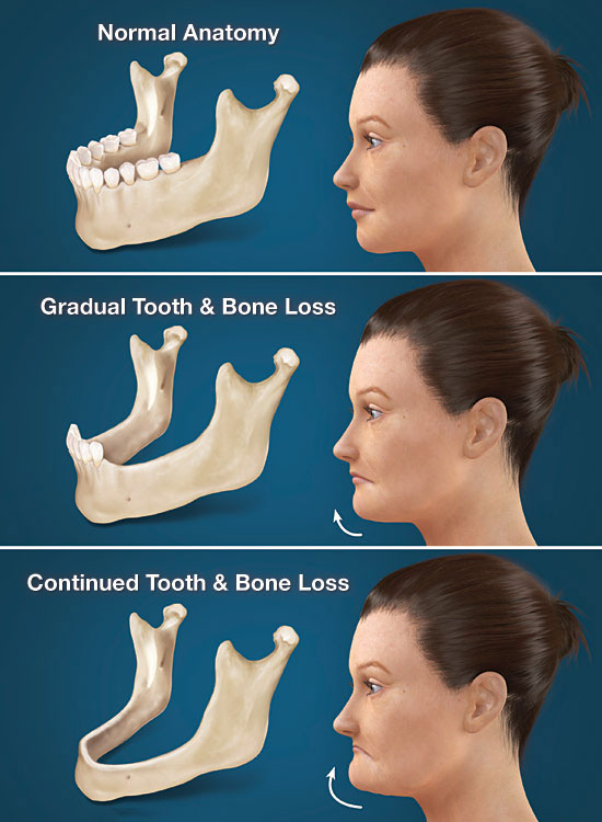 Jawbone infographic